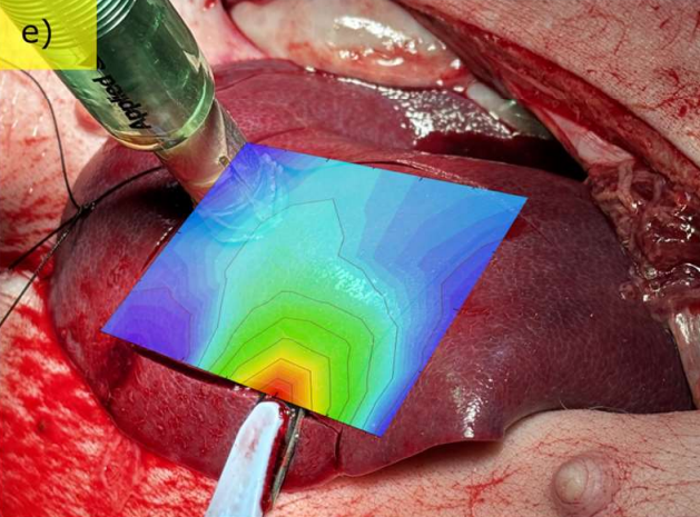 In-Vivo Study on the Safe Use of a Novel Intraoperative Sensing Tool for Tissue Stiffness Assessment in Endoscopic Surgery