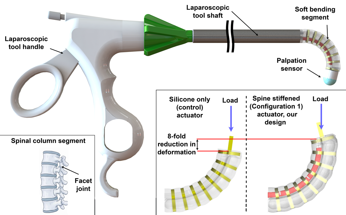 PALPABLE: Enhanced Bending Stiffness and Proprioception in Soft Actuators for Laparoscopic Palpation